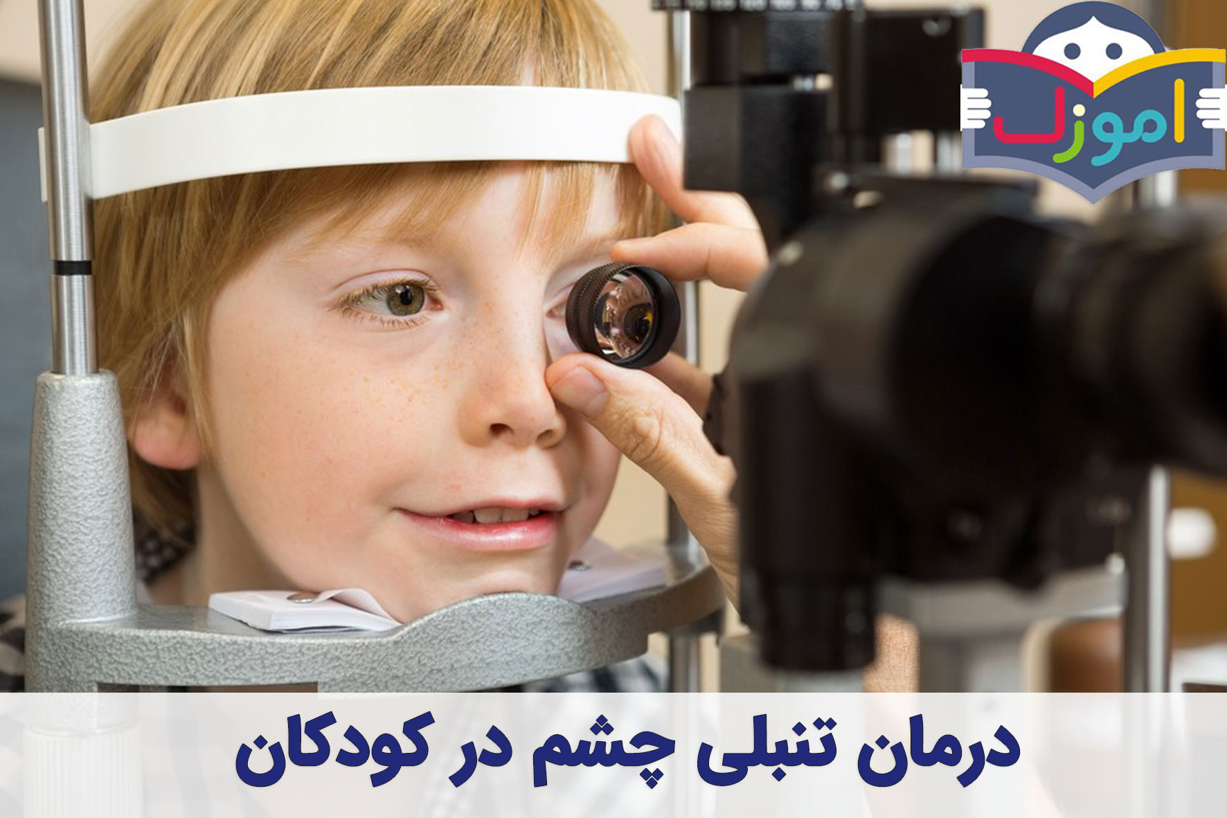 درمان تنبلی چشم (Amblyopia) در کودکان
